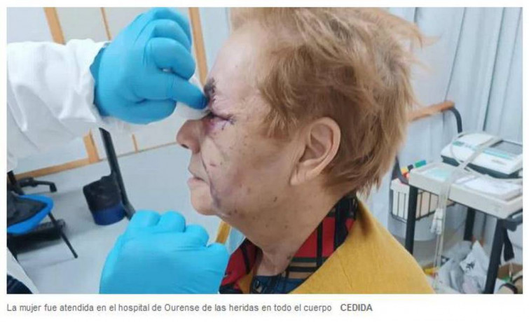 Ferida moi grave por ataque duns cans en Muiños